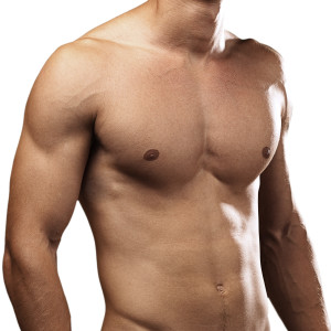 gynecomastia